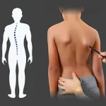 Cocuklarda Skolyoz terapisi