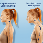 boyun duzlesmesi