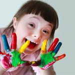 down sendromu tedavi