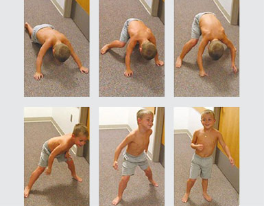 Kas Hastalıkları 1 kas hastaliklari