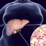 metabolizmal hastaliklarda refleksoloji