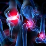 ortopedik rehabilitasyon